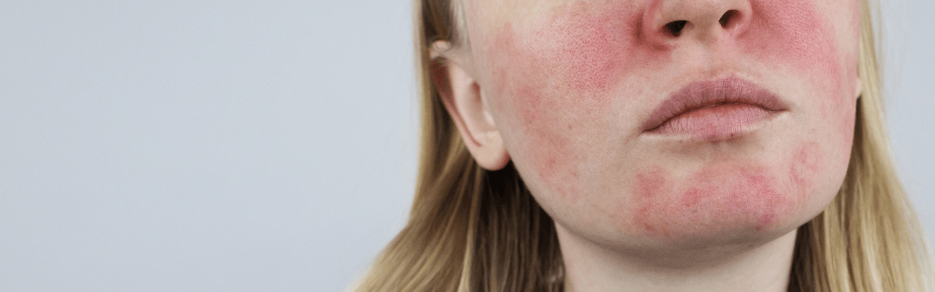 bright pink spots on skin
